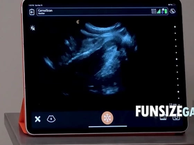 Ultra sound penetration inspection - dr wolf, austin swang taiwan gay porn